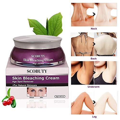 Read more about the article Skin Lightening Cream, Whitening Cream, Brightening Cream, Melasma Treatment Cream, Freckle Removal Cream For Face Brightening, Dark Spot, Skin Pigmentation (1.06 Oz)