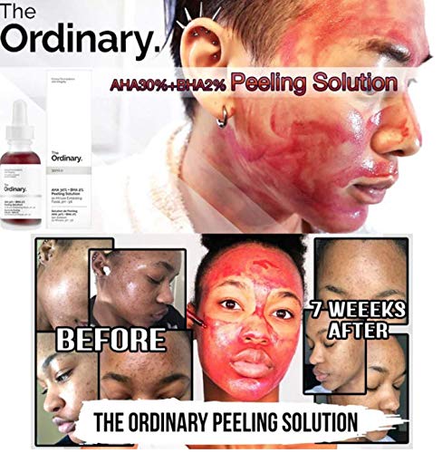 You are currently viewing THE ORDINARY AHA 30% + BHA 2% PEELING SOLUTION 30ML